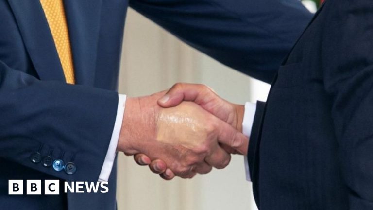 Vizual pentru afecțiunea venelor trump pe Top10stiri.ro