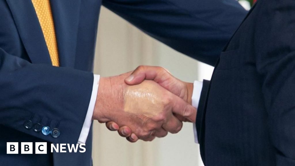 Ce este afecțiunea venelor lui Trump și cât de gravă este?