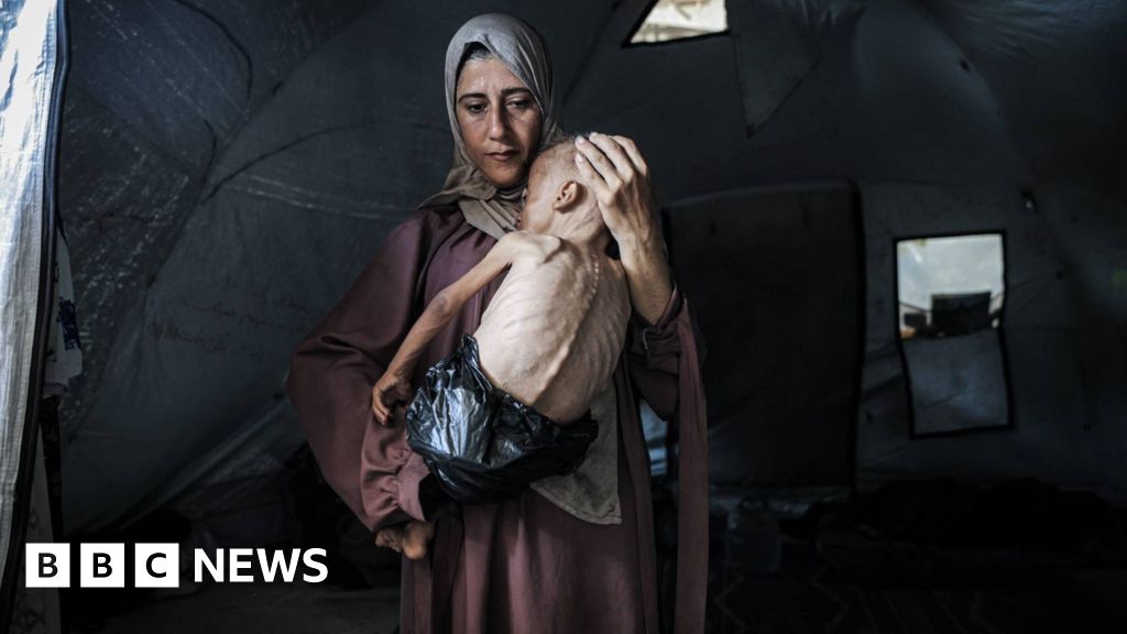 Grupurile umanitare avertizează că locuitorii din Gaza „decedează” pe măsură ce foametea se răspândește în masă