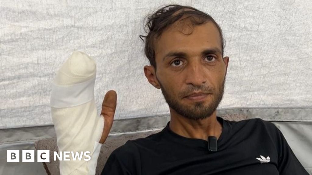 Un gazan rănit a declarat pentru BBC că am putea muri, dar trebuie să facem rost de mâncare.