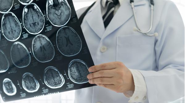 Reţeaua de spitale care pot trata pacienţii cu AVC a fost extinsă. Lista actualizată a centrelor medicale