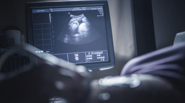 femeie rămas însărcinată - Imagine ilustrativă